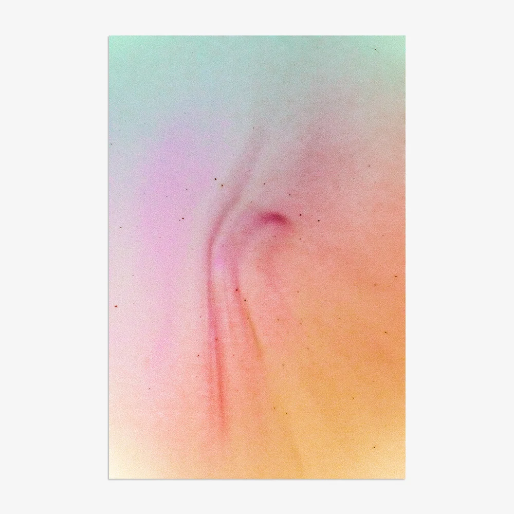 Reverse Plasma Formation 7 - Image 7